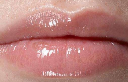 蘭州比較靠譜的去口周紋整形醫(yī)院是哪家？2023年蘭州去除口角紋綜合排名揭曉，這幾家口周紋醫(yī)療整形醫(yī)院實力