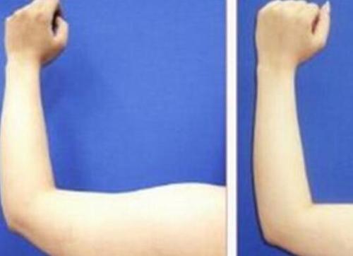 綿陽(yáng)鼻背寬整形醫(yī)院推薦！2023綿陽(yáng)鼻背寬美容醫(yī)院排行榜出爐，網(wǎng)友大贊這些！