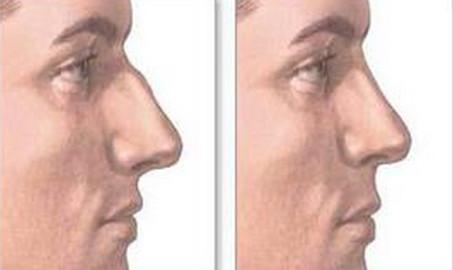 2023年合肥治療筒狀乳房畸形首選的專業(yè)整形醫(yī)院排行榜TOP10強(qiáng)推薦！