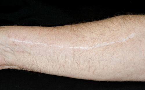 昭通自體脂肪填充胸部醫(yī)生