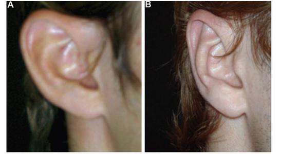 鄭州治療老年斑有口碑的整形醫(yī)院推薦！附2023年鄭州消除老年斑前十強(qiáng)排行！