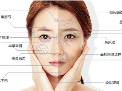 廣州臉部打溶脂針排名前10的美容醫(yī)院口碑大揭秘！2023年很受好評(píng)的整形醫(yī)院技術(shù)盤(pán)點(diǎn)！