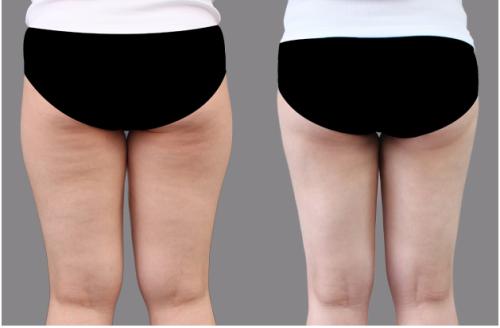 無錫瘦臉除皺塑形整形醫(yī)院排行榜2023，權威專家PK綜合評價前十