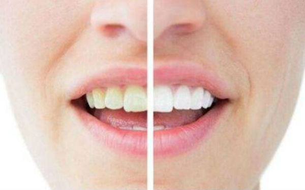 深圳豐太陽(yáng)穴整形醫(yī)院口碑非好好！2023年十佳面部注射豐太陽(yáng)穴醫(yī)院排名出爐