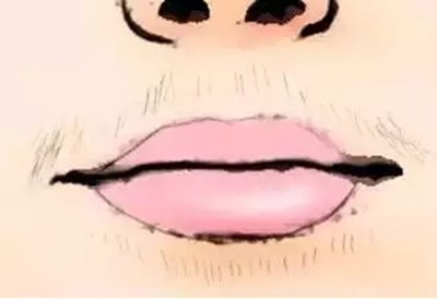 泰州鼻唇溝醫(yī)療美容醫(yī)院口碑好的推薦！2023泰州肉毒素打鼻唇溝top10強(qiáng)勢醫(yī)院震撼登場！