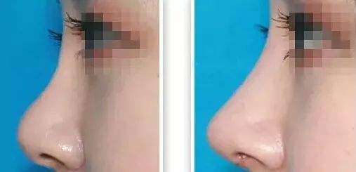 2023寧波頭部皺紋祛除醫(yī)院口碑排行榜top10公開總結(jié)！