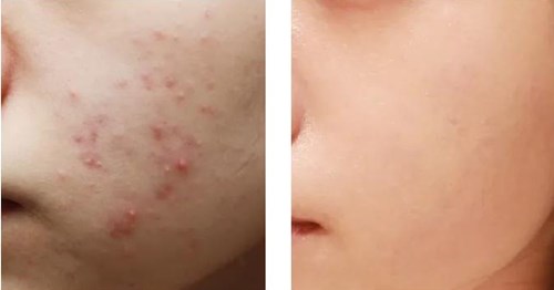 【重慶法令紋填充正規(guī)整形醫(yī)院】-2023年前十位權(quán)威醫(yī)生傾情推薦！