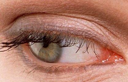 2023年口碑爆棚！蘇州肉毒素整形美容醫(yī)院排名前10，暢銷！