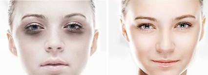 北京哪些醫(yī)院的激光去黑頭效果好？2023年排名前10的強(qiáng)整形醫(yī)院推薦！