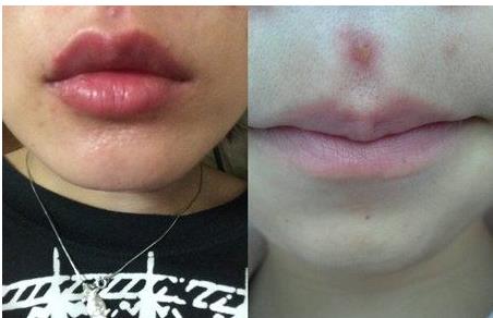 2023青島哪些醫(yī)院口碑好，提供專業(yè)的提拉魚尾紋醫(yī)療美容服務(wù)？青島魚尾紋醫(yī)院TOP10強(qiáng)機(jī)構(gòu)推薦