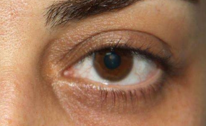 唐山哪家專業(yè)整形醫(yī)院在韓式微創(chuàng)雙眼皮恢復(fù)方面經(jīng)驗豐富？2023年唐山醫(yī)療整形院雙眼皮恢復(fù)排名前十可信賴嗎