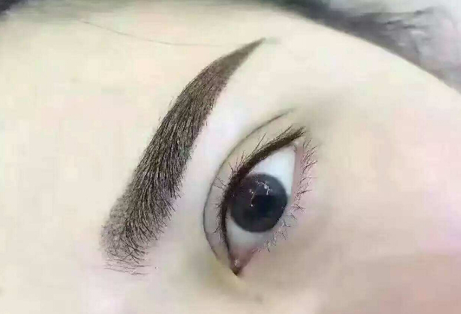 鄭州眉間紋淡化，2023年十大整形美容醫(yī)院推薦