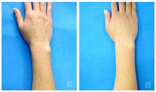 杭州哪家整形美容醫(yī)院能有效避免眼部皺紋？2023年杭州眼部皺紋美容醫(yī)院前十位排行榜來啦！