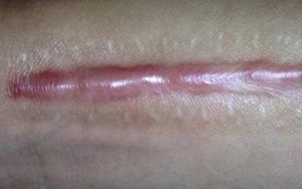 2023蘇州面部皺紋填充醫(yī)院排名揭曉！哪家醫(yī)院在皺紋填充領(lǐng)域名列前茅？