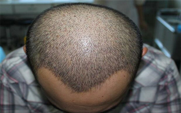 河北知名美容醫(yī)院推薦！2023鼻唇溝手術(shù)醫(yī)療整形醫(yī)院排名前十