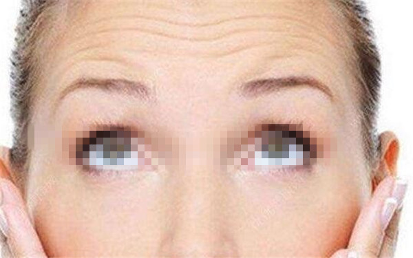 西安治療面部皺紋的著名醫(yī)院推薦！2023年排名前十，絕對(duì)值得考慮！