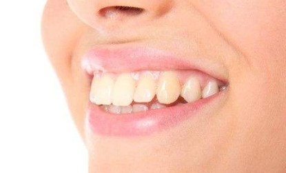 2023杭州口周紋整形醫(yī)院口碑好的有哪些？杭州物理去口周紋醫(yī)院排名揭曉！