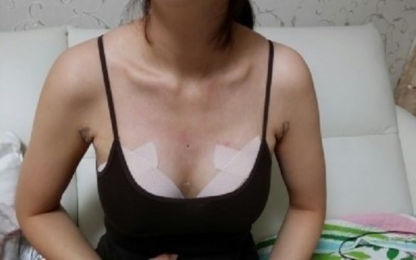 2023年北京注射脂肪隆胸醫(yī)院排名top10，讓你不再為選擇糾結(jié)！