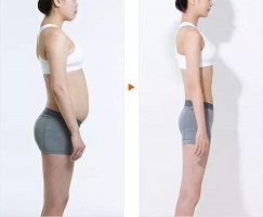 攀枝花市2023年最值得關(guān)注的高性價(jià)比v臉線雕醫(yī)院排行榜