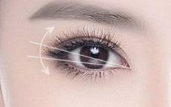 上海哪家醫(yī)院提供專業(yè)光纖溶脂祛魚尾紋服務(wù)？2023最新排名揭曉！