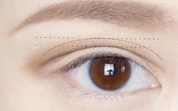 2023常州面部皺紋祛除美容醫(yī)院排名推薦！常州哪家整容醫(yī)院在祛除面部皺紋方面頗具權(quán)威？