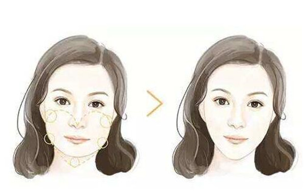 南京哪家整形醫(yī)院能有效去除面部皺紋？2023年南京治療面部皺紋醫(yī)院排名前10強！