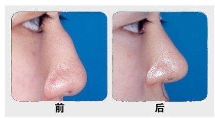 2023武漢去除口周紋醫(yī)院排名榜！高口碑醫(yī)院為你推薦