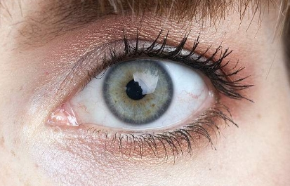 深圳哪個(gè)醫(yī)院的顴骨降低整形效果？2023年度排名前十大整形醫(yī)院點(diǎn)評(píng)！