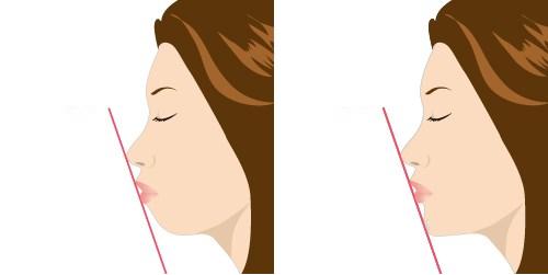 2023鄭州哪家口碑不錯的切開填充去痘疤整形美容醫(yī)院排行榜發(fā)布，前10強揭曉！