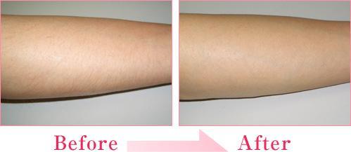 2023年哈爾濱治療動(dòng)態(tài)細(xì)紋的醫(yī)院排名，不容錯(cuò)過的十家！