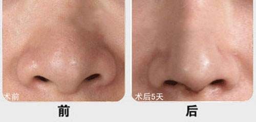 漳州有哪些性價(jià)比高的雙眼皮微創(chuàng)抽脂醫(yī)院？2023年漳州雙眼皮微創(chuàng)抽脂醫(yī)院排名前十更新！