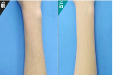 2023年西安陰道緊縮術修補醫(yī)院推薦TOP10強熱門評分揭曉！