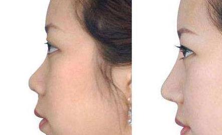 太原哪家醫(yī)院專業(yè)斑點祛老，口碑比較好？2023太原斑點祛老美容醫(yī)院排名TOP10熱門機構推薦！