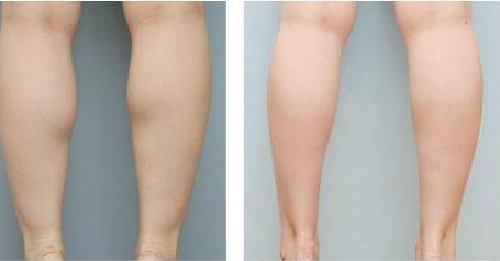 2023年天津韓妃開(kāi)眼角手術(shù)醫(yī)院排名及性?xún)r(jià)比推薦！整形美容行業(yè)的權(quán)威榜單揭曉