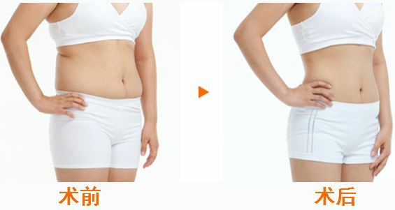 合肥鼻翼鼻頭縮小的醫(yī)療機(jī)構(gòu)，性價(jià)比高的有哪些？合肥2023年前10名醫(yī)療整形醫(yī)院詳盡概況！