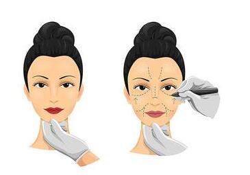 福建哪家整形醫(yī)院專業(yè)除眼皺紋效果好？2023年福建除眼皺紋評(píng)分十強(qiáng)醫(yī)院公布！