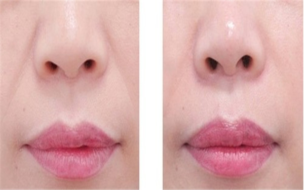 揭秘2023年海南十大專業(yè)除眼紋醫(yī)療美容醫(yī)院，哪些值得考慮！