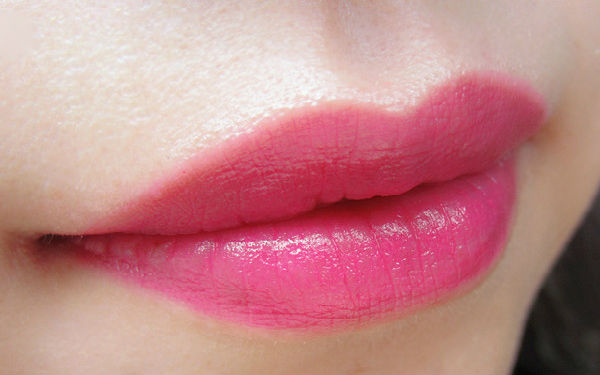 2023上海很受歡迎的射頻吸脂瘦肩部整形醫(yī)院排行榜公布！看看哪些醫(yī)院值得選擇