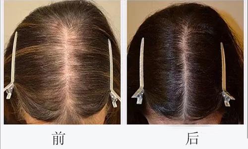 廣州哪些醫(yī)院可靠，專業(yè)進行臉部疤痕切除整形美容？2023年十大排名公開！