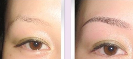 2023年漳州光子嫩膚脫毛正規(guī)醫(yī)療整形醫(yī)院評價TOP10強(qiáng)參考-誰的性價比比較高？