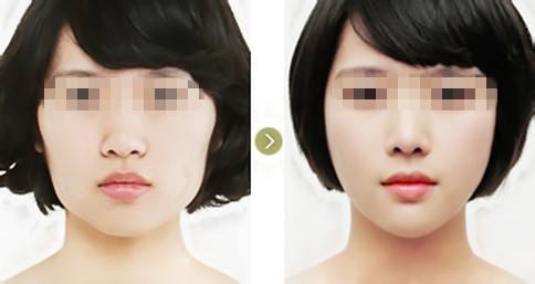 2023年濟南頸部皺紋填充醫(yī)療美容醫(yī)院哪家綜合實力更強？瀏覽排名前十強名單！