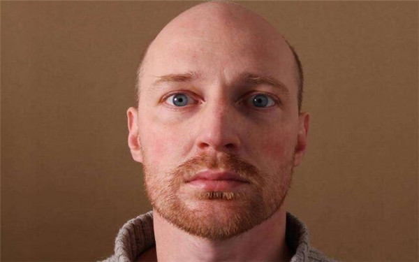 2023年舟山韓式開眼角手術醫(yī)院推薦，口碑爆棚的前10家醫(yī)院盤點！