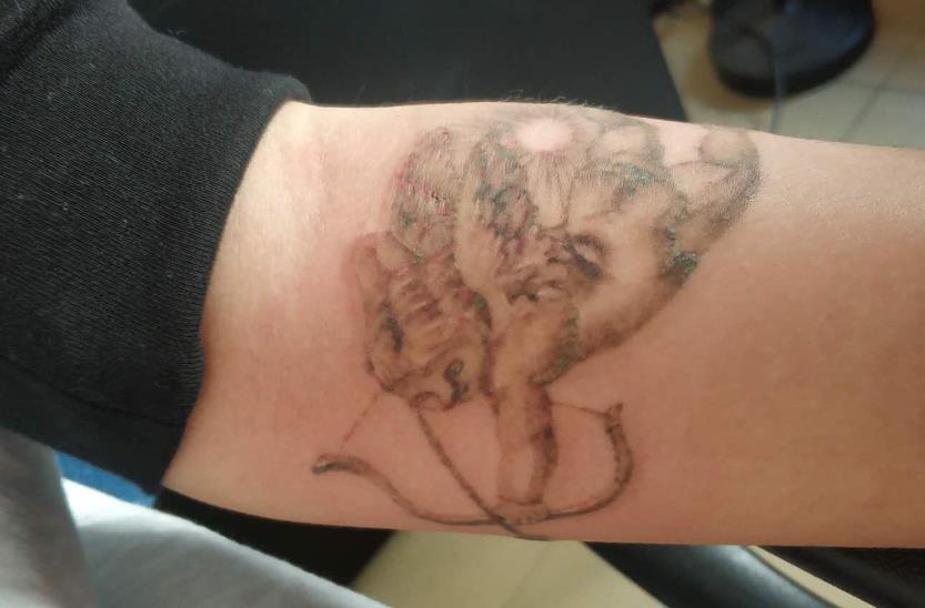 宿遷洗紋身醫(yī)院榮獲六強(qiáng)名單，口碑彰顯實(shí)力！