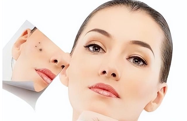 2023昆明哪家整形美容醫(yī)院面部去痣口碑比較好？評(píng)分10強(qiáng)你知道嗎？