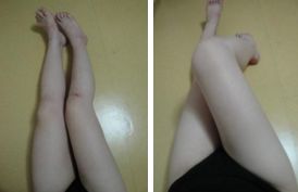 北京納米脂肪移植公立醫(yī)院排名概覽：最新排名，權威推薦，專業(yè)領航，2025版