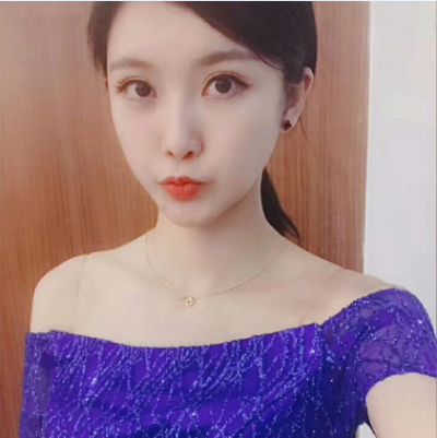 眼綜合術(shù)前VS術(shù)后，自然大眼睛值得稱贊！