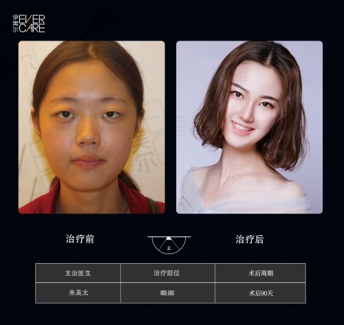 阿爾法9°美眼，打開視界，美無止境