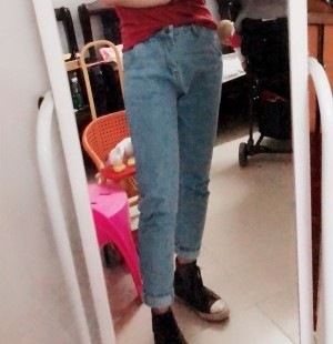 胖腿女孩兒福利分享：吸脂瘦大腿的蛻變，效果值得點贊！