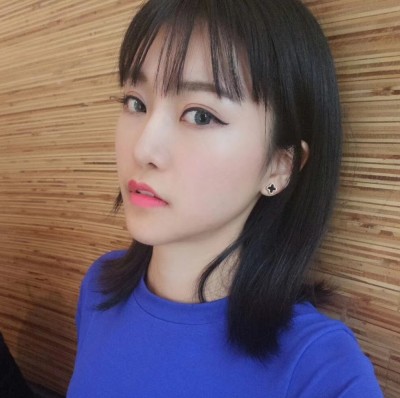 眼綜合術(shù)前VS術(shù)后，自然大眼睛值得稱贊！