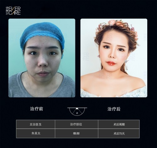 阿爾法9°美眼，打開視界，美無止境